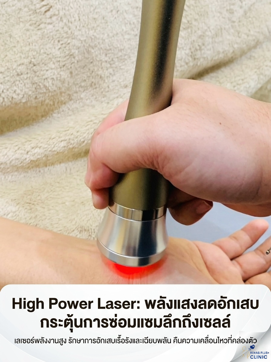 เครื่อง High Power Laser